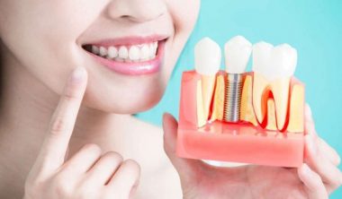 مميزات عمليات تجميل وتصليح الأسنان في الأردن