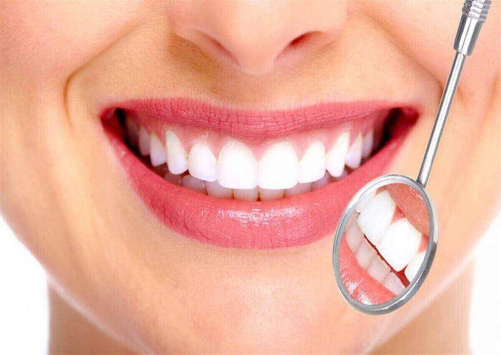 أنواع تركيب الأسنان التجميلية