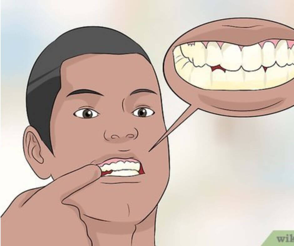  استخدام فرشاة الأسنان ومعجون الاسنان