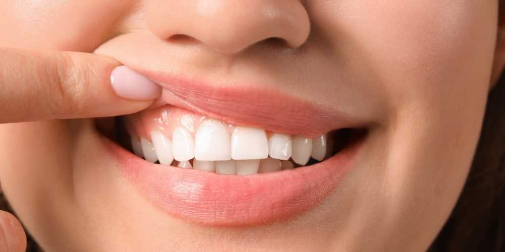 العوامل التي تسبب في تكاثر أنواع بكتيريا الأسنان
