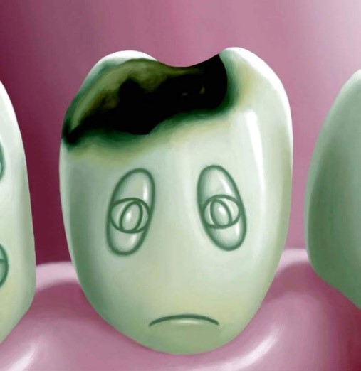 طرق انتقال أنواع بكتيريا الأسنان المختلفة إلى الفم