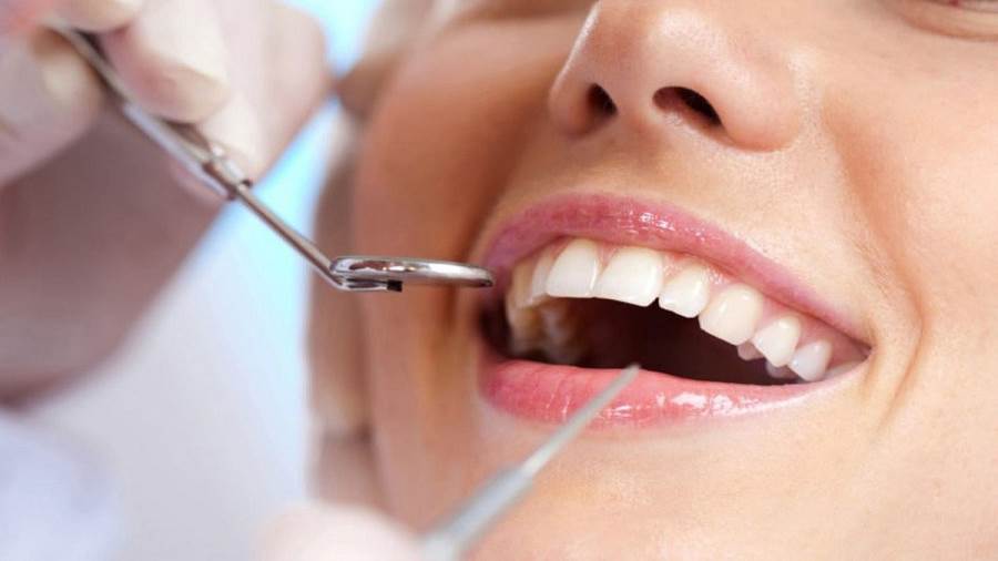 عادات من أجل المحافظة على صحة الأسنان