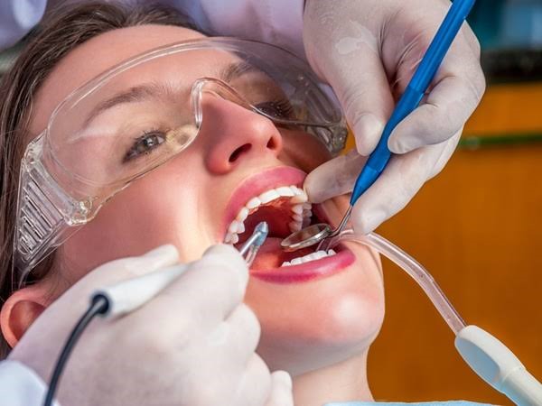 عمليات تنظيف الأسنان عند الطبيب