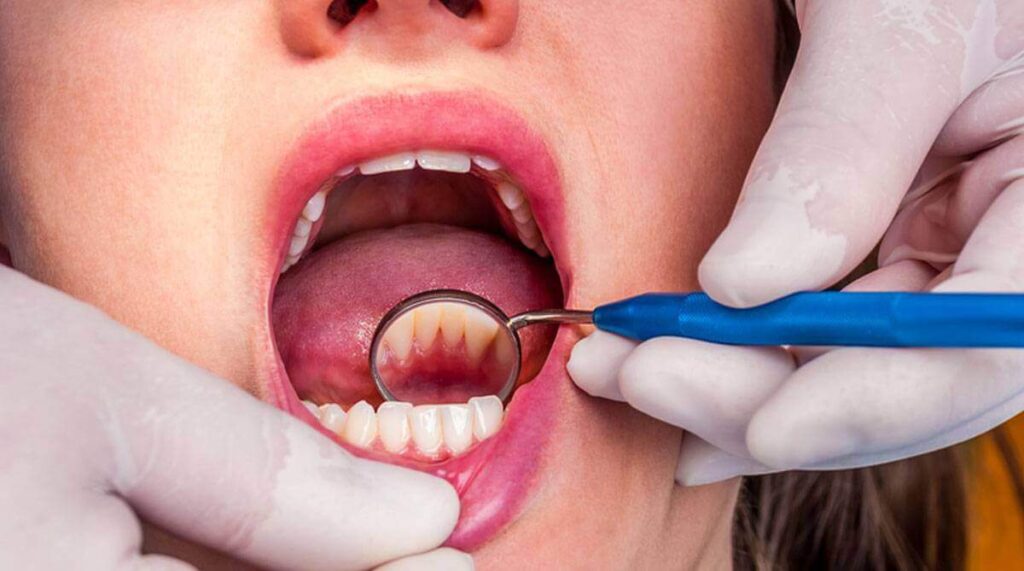 هل عملية تنظيف الأسنان عند الطبيب مؤلمة؟