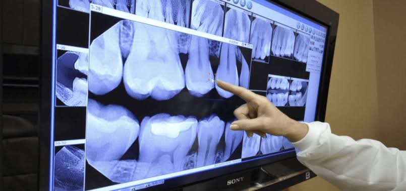 أبرز مميزات طب الأسنان الرقمي