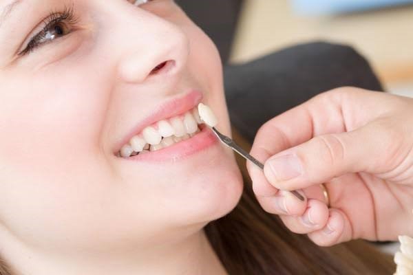عوامل مدّة زراعة الأسنان